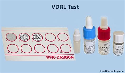 VDRL test .